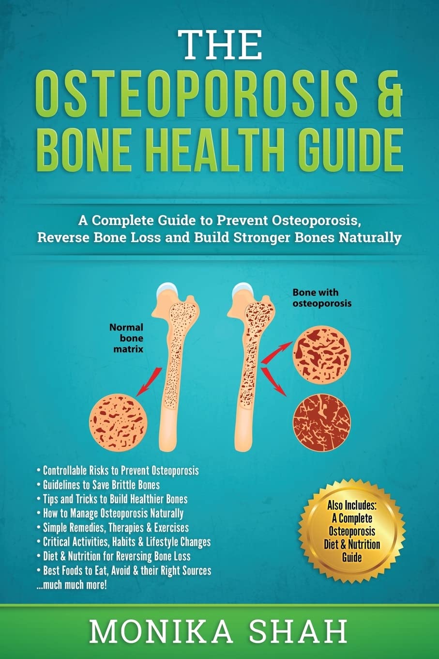 Bone Health and Osteoporosis Treatment in Rochester, NY: Expert Care for Stronger Bones
